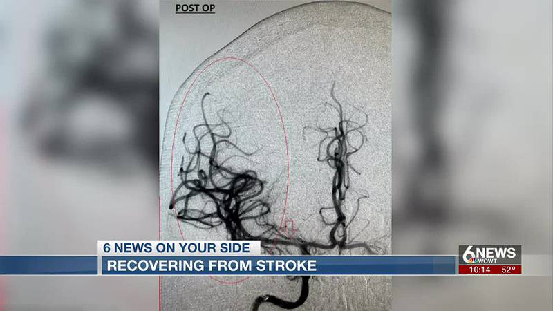 A Papillion couple has been through quite the journey after they suffered two strokes.